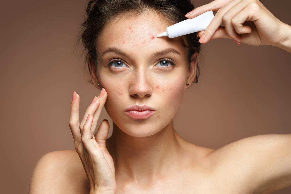 Problemas de pele: 3 razões porque os tratamentos convencionais podem não estar a resultar contigo